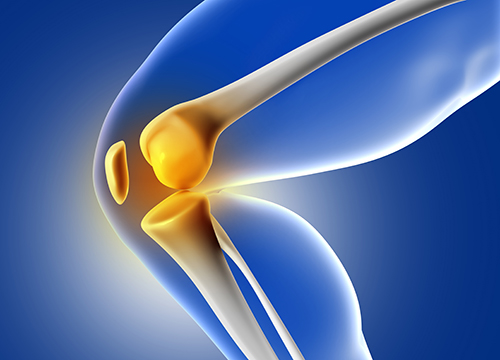 Arthiritis Wellness Profile