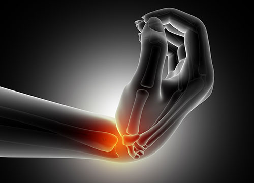 Bone Health Wellness Profile